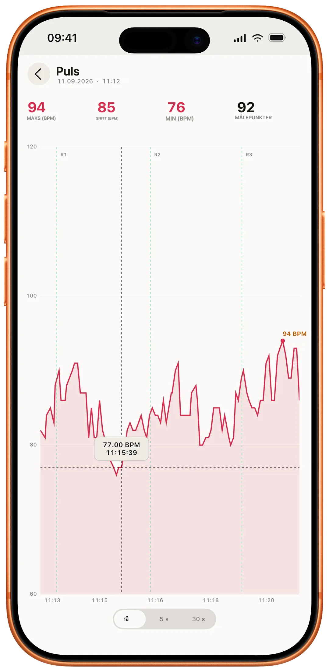Puls